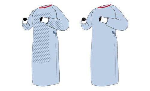 AAMI Level 4 Performance/EN13795 High Performance